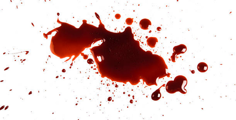 Blood Splatter- iStock